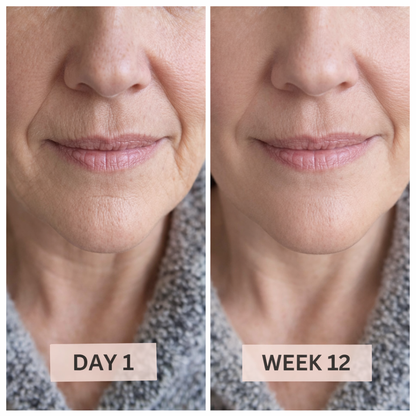 Lumea Wave 6-in-1 RF Rejuvenating Device