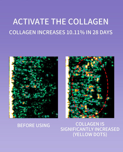 Lumea Wave 6-in-1 RF Rejuvenating Device